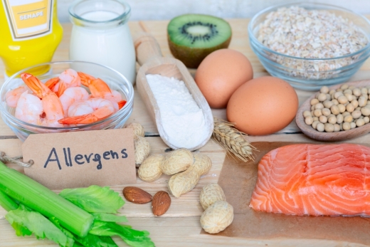 Allergenkennzeichnung im Online-Handel 2026: Pflichtangaben, Fallstricke